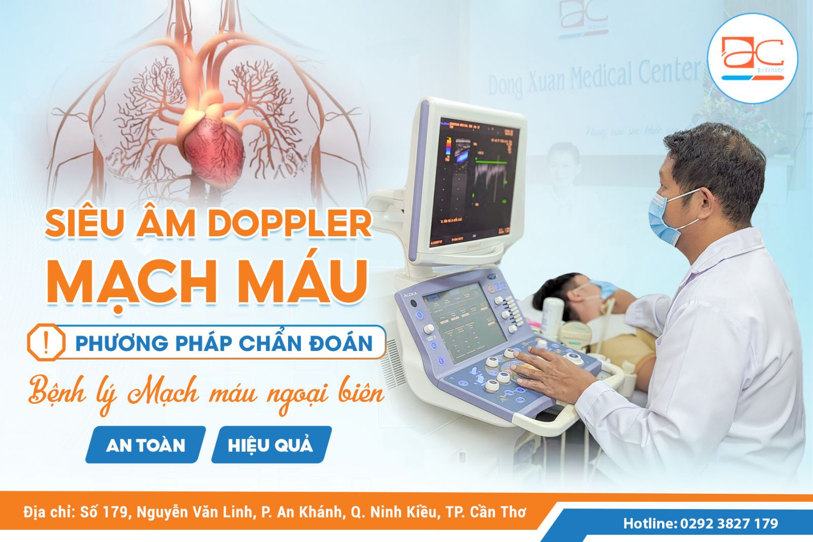 SIÊU ÂM DOPPLER MẠCH MÁU