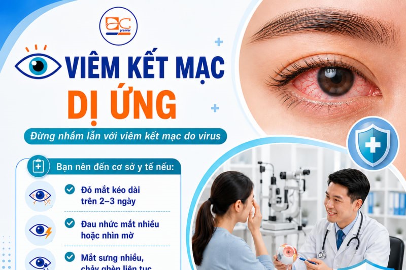 VIÊM KẾT MẠC DỊ ỨNG – ĐỪNG NHẦM LẪN VỚI VIÊM KẾT MẠC DO NHIỄM VIRUS